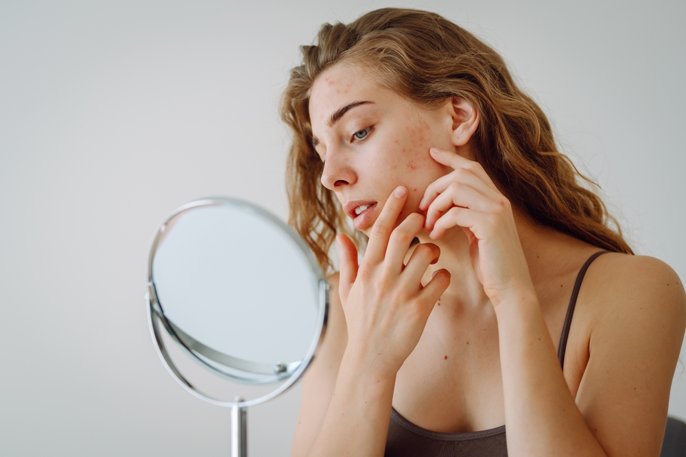 Dermatologist in Guntur treating acne
